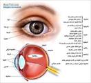 ساختار چشم و بیماری کاتاراکت